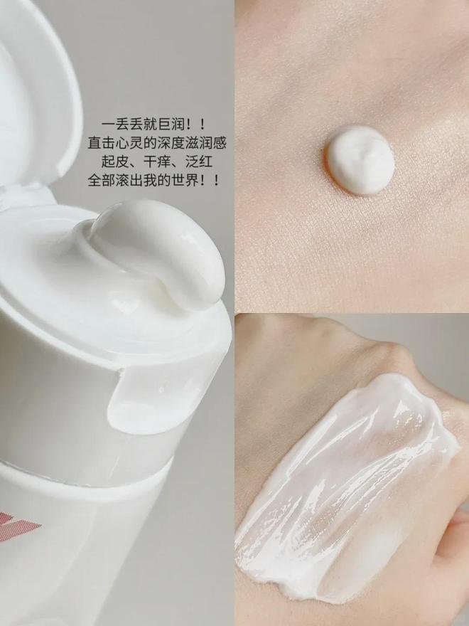 皮肤干痒刺挠有救了！PG电子麻将胡了秋冬(图8)